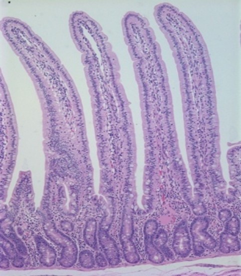 Microscopic image showing elongated, finger-like villi structures of intestinal tissue stained pink and purple, highlighting cellular detail and tissue organization.