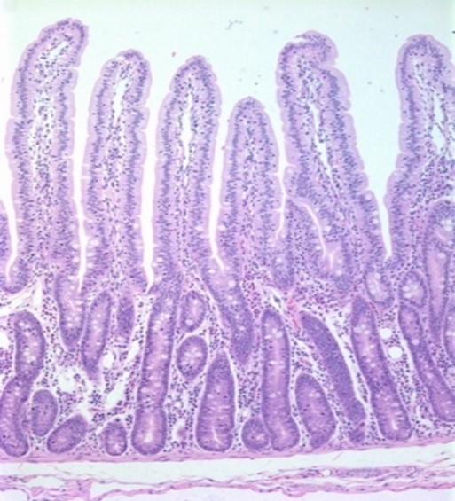 Microscopic image of intestinal villi showing tall, finger-like projections lined with purple-stained cells, typical of normal small intestine tissue under a light microscope.