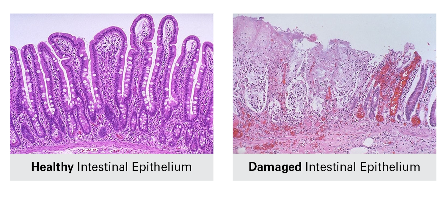 healthy vs. damaged intestinal wall, gut wall in a pig eating a simple nursery diet vs. a complex diet. graphic