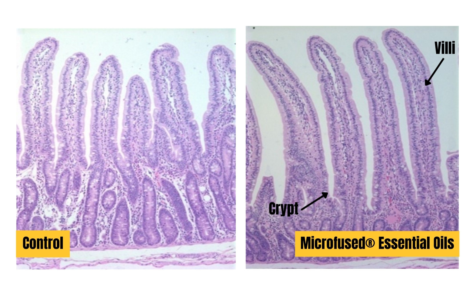 villi and crypt depth of intestinal wall. healthy vs. unhealthy