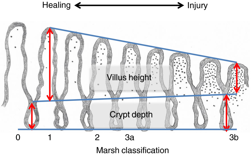Healed vs. Injured Villi and Crypts in the Gut graphic