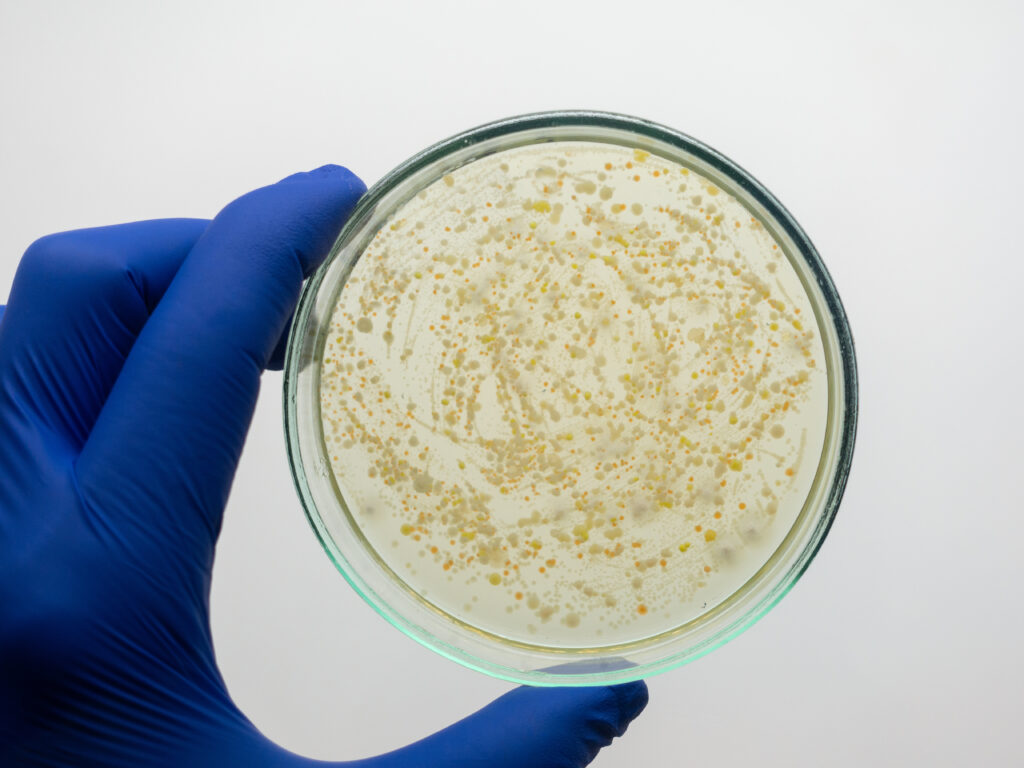 A gloved hand holds a petri dish containing yellowish bacterial colonies growing on a white agar surface, viewed from above against a plain white background.