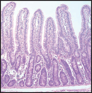 Microscopic view of intestinal villi showing tall, finger-like projections lined with cells, typical of healthy small intestine tissue stained with hematoxylin and eosin.