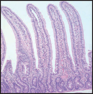 Microscopic image of healthy intestinal villi, showing finger-like projections lined with epithelial cells and a clear underlying connective tissue, stained pink and purple for contrast.