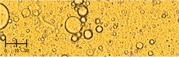 Microscope image showing numerous circular vesicles of varying sizes dispersed on a yellow background. A scale bar in the lower left corner indicates measurements of 0, 10, and 20 micrometers.