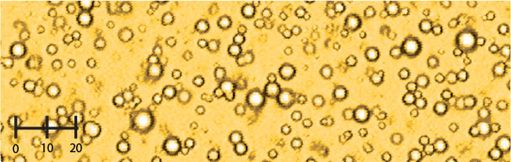 Microscopic image showing numerous small, circular or ring-shaped structures scattered across a yellow background. A black scale bar marked 0, 10, and 20 is visible in the lower left corner.