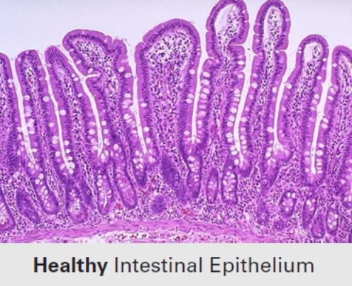 Microscopic image of healthy intestinal epithelium stained purple, showing tall, finger-like villi and a dense layer of epithelial cells. Text below reads “Healthy Intestinal Epithelium.”.